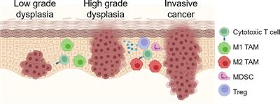 Genetic Changes Driving Immunosuppressive Microenvironments in Oral Premalignancy